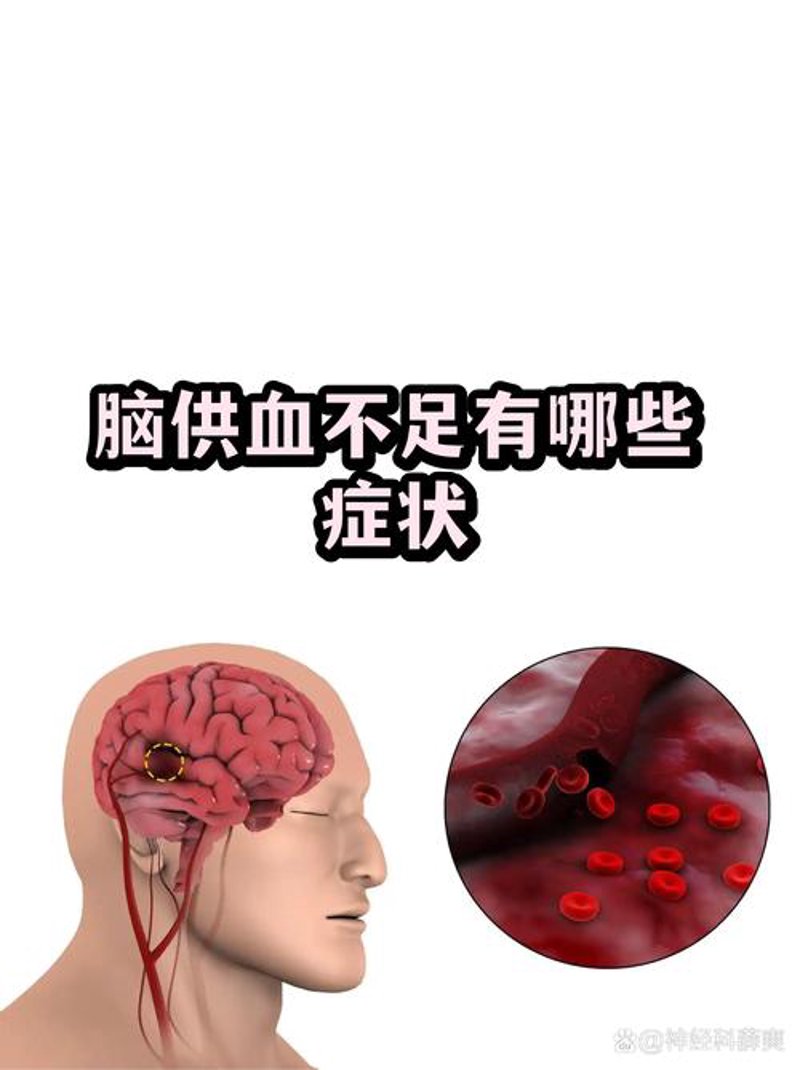 脑血管病