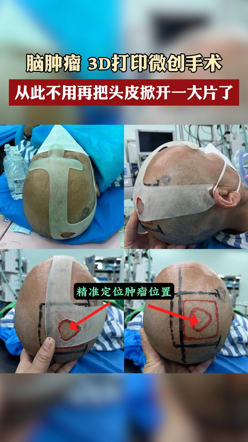 脑科疾病的常见疑问与解答