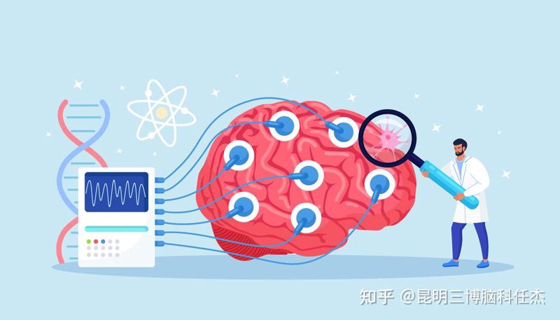 帕金森治疗选购指南