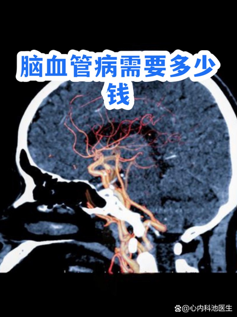 解析脑科疾病的最新研究进展与未来趋势